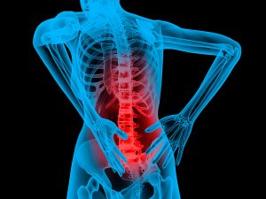 lower back pain - Aleve Direct Therapy