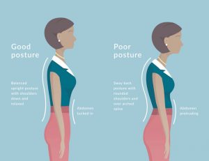 effects of bad posture