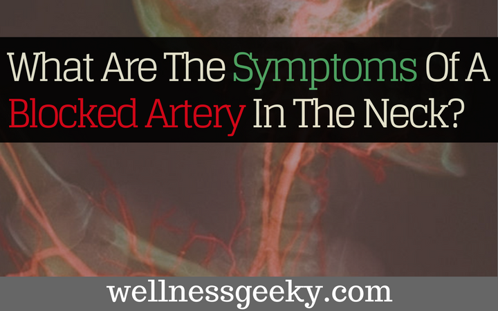 What Are The Symptoms Of A Blocked Artery In The Neck?
