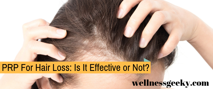 PRP For Hair Loss: Is It Effective?