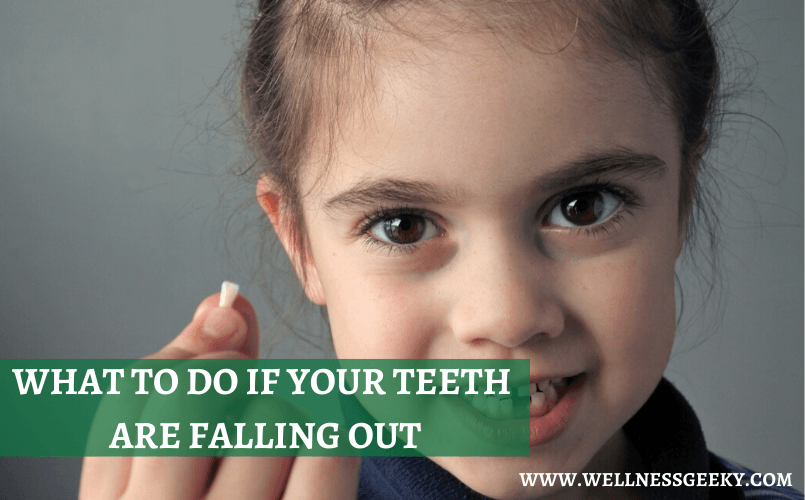 What to Do If Your Teeth are Falling Out